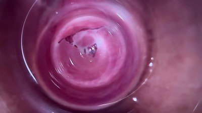 Camera deep inside nubile creamy vagina